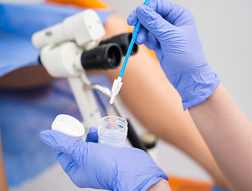 การเก็บสิ่งส่งตรวจจากช่องคลอดด้วยตัวเองเพื่อตรวจหาเชื้อ HPV (Self-Collected HPV Testing)