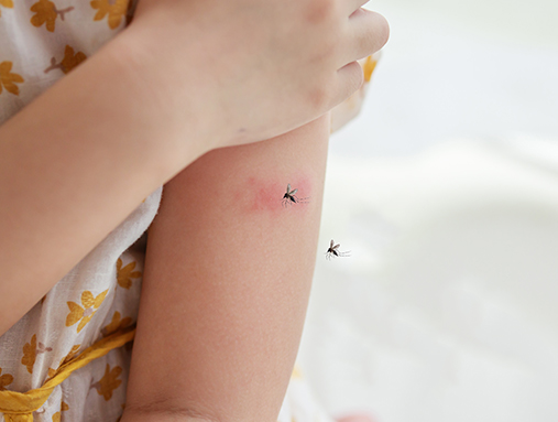 ไข้เลือดออก